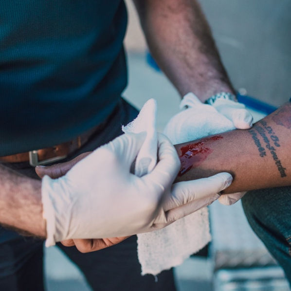 medical person treating open wound