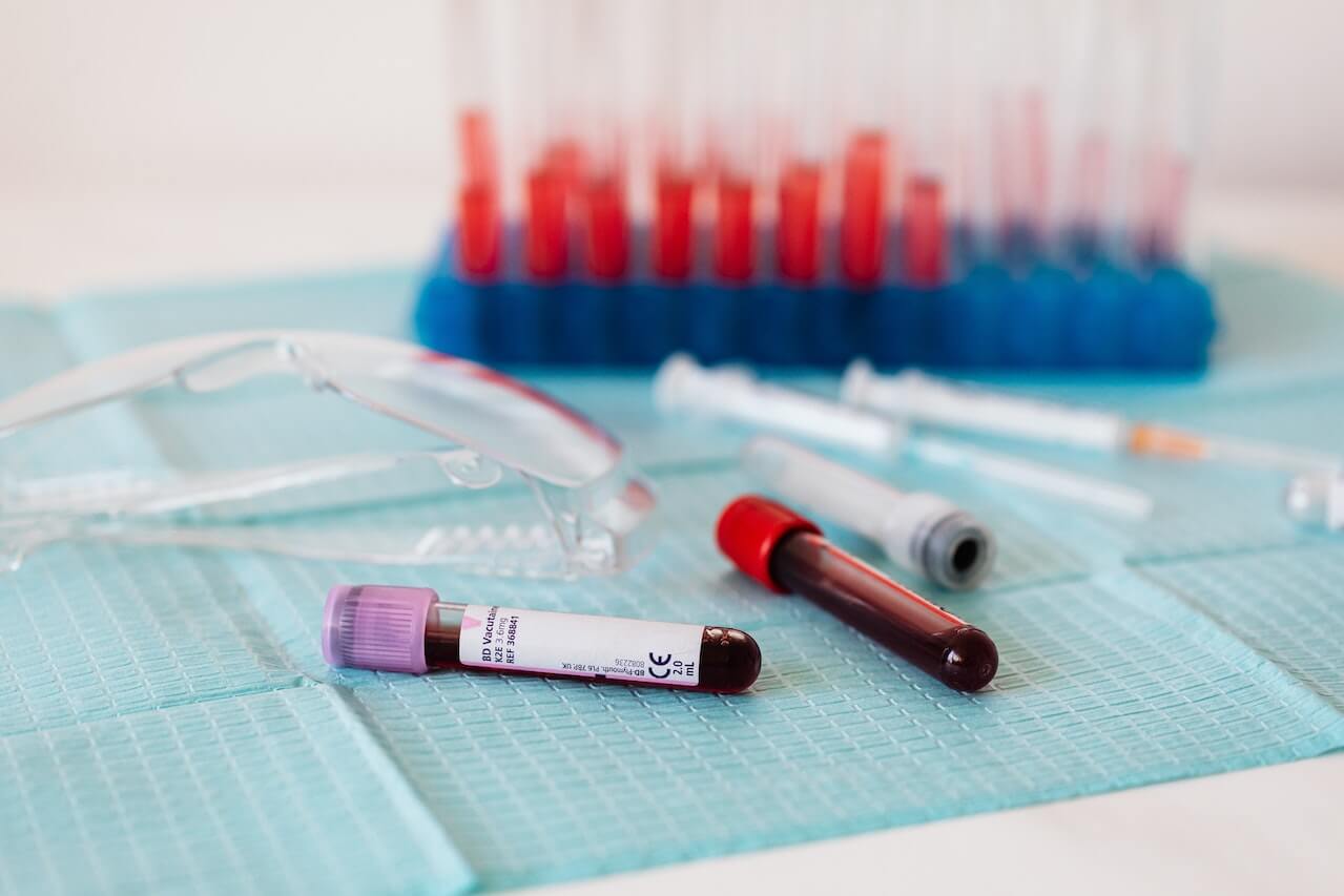 Full vials of blood near various medical equipment for taking blood.